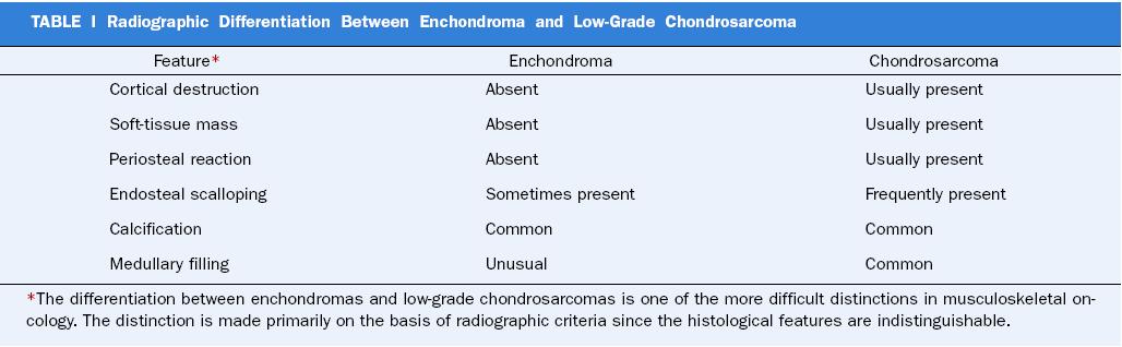 Chondrosarcoma 1