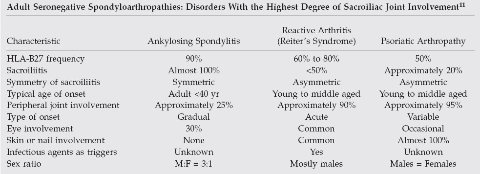 Sacroiliac Joint Pain 1