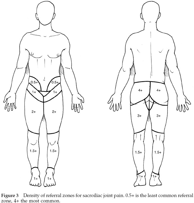 Sacroiliac Joint Pain 2