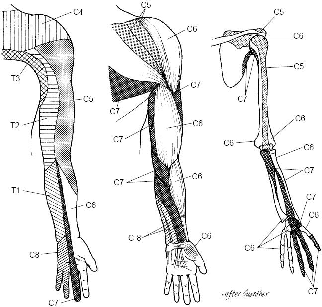 Cervical Radiculopathy 1